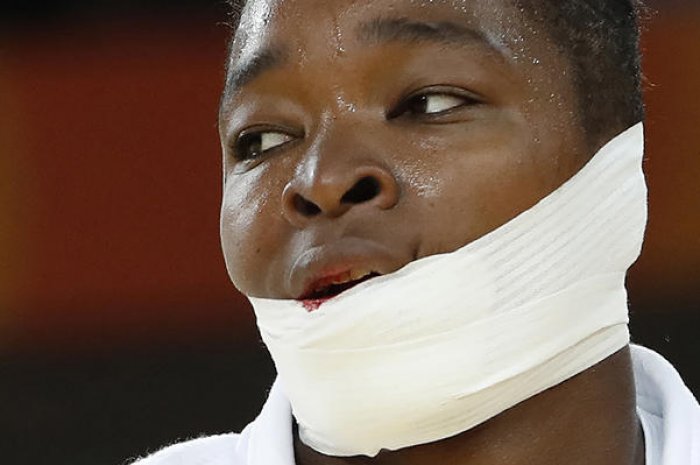 La judokate Audrey Tcheumeo victime d'une blessure à la lèvre