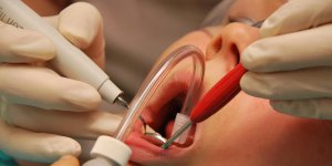 Mutilations et escroqueries : le témoignage d'une victime du "dentiste de l’horreur"