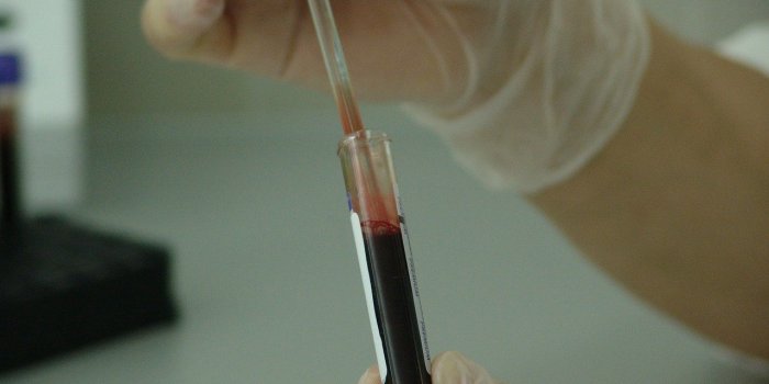 Les tests de dépistage du VIH, gratuits dans le Sud-Est