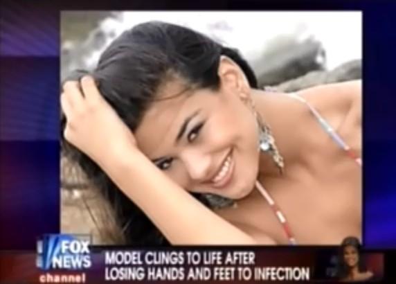 Mariana Bridi da Costa, Miss Brésil décède d'une infection urinaire