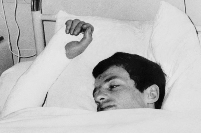 Jean-Paul Belmondo blessé après son accident de voiture en 1960