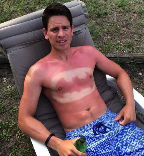 Le sunburn art ou l'inquiétant tatouage coup de soleil