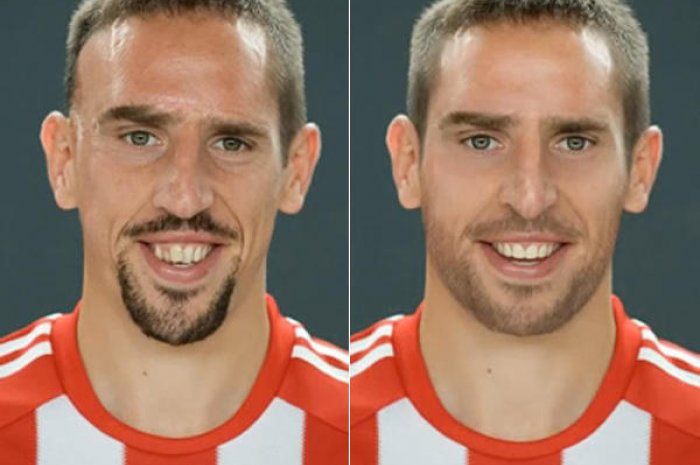 Avant/après : l'incroyable transformation de Franck Ribéry