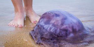L’effrayante piqûre infligée par une méduse à une nageuse