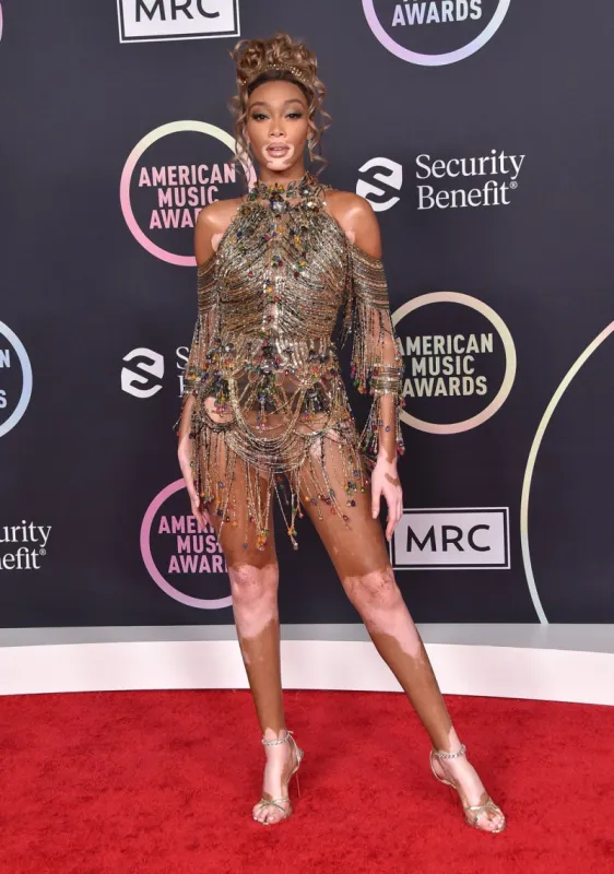 winnie harlow arriving at the 2021 american music awards held at the microsoft theatre on november 21, 2021 in los angeles, ca, usa photo by o'connor aff abacapresscom , 788937 007 los angeles etats-unis united states