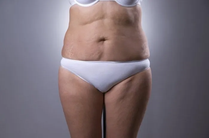 flabby woman's belly with stretch marks on a gray background