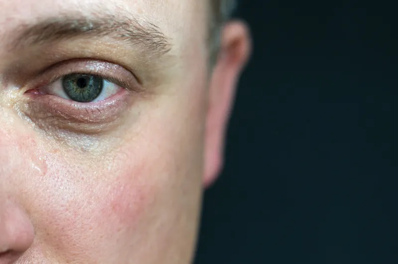 sad and painful look of a young man against a black background