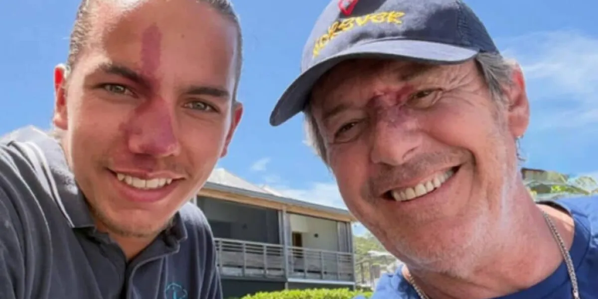 Jean-Luc Reichmann : 14 ans après leur première rencontre, l'animateur retrouve Gabin lui aussi marqué par un angiome sur le visage