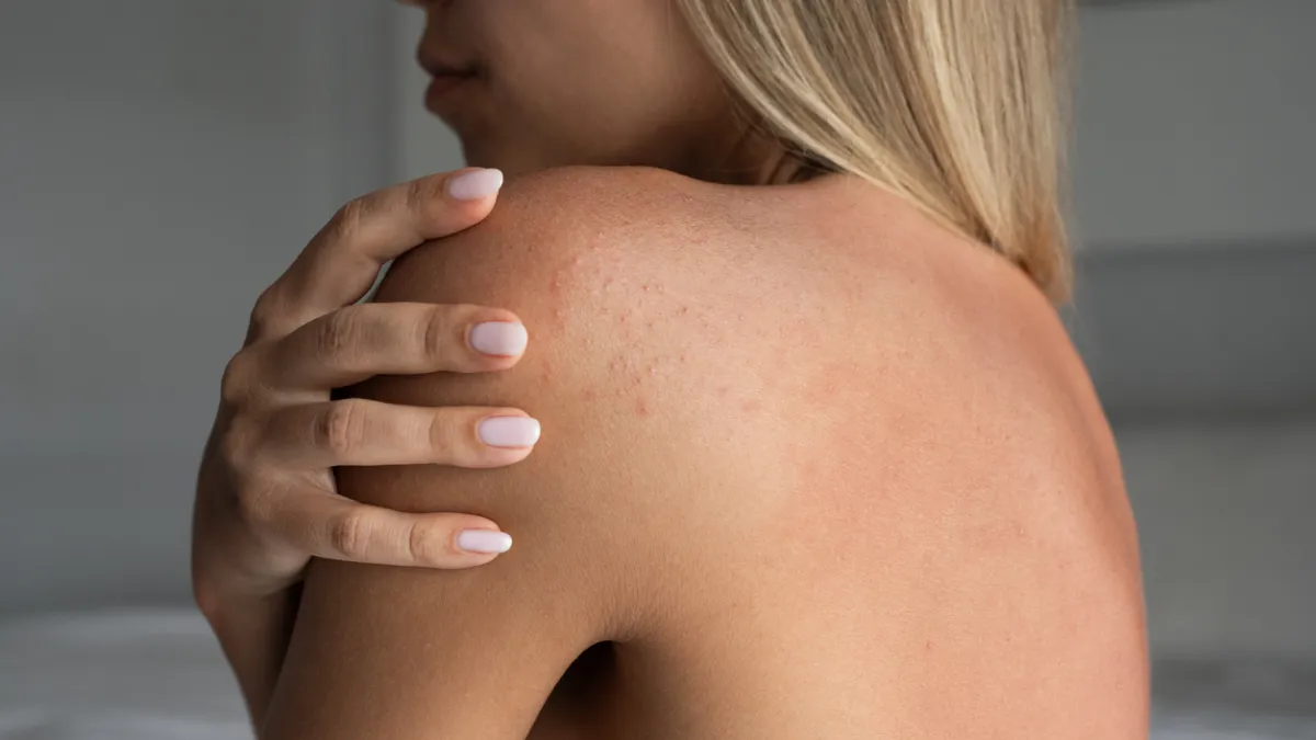 Canicule et soins du visage : les stratégies d'une experte pour protéger sa peau sans l'obstruer