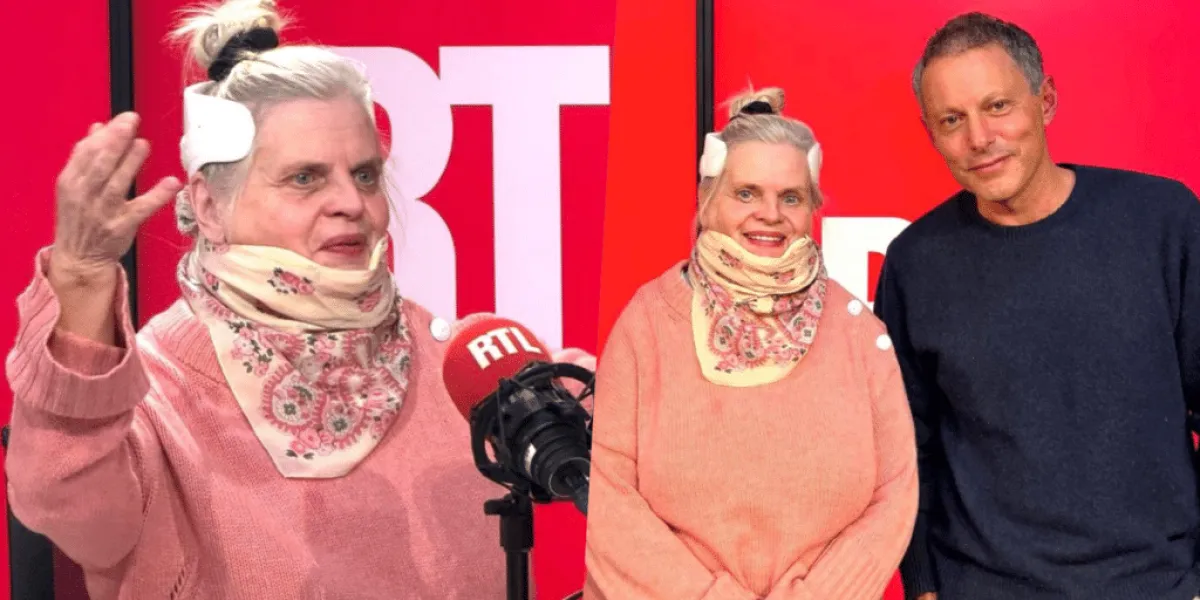 Isabelle Nanty : sa nouvelle tête après l’accident dévoilée et c’est impressionnant