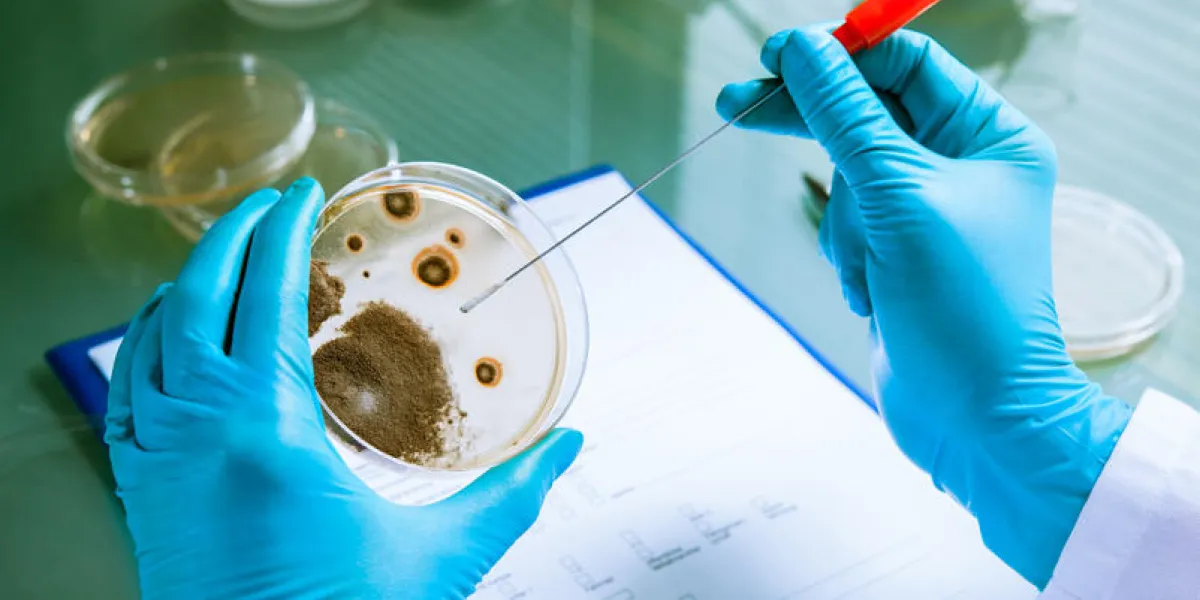 germs growing on an agar plate in laboratory