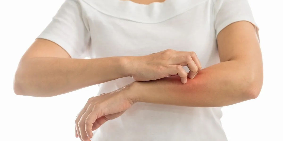 itching of skin diseases in women using the hand-scratching red around the itching area concept with healthcare and medicine