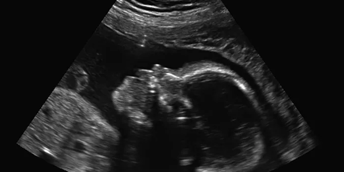 échographie en noir et blanc de bébé chez la femme enceinte