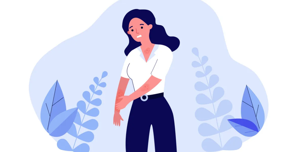 sad woman scratching skin female character suffering from strong eczema or allergy vector illustration for disease, dermatology, sickness, symptoms concept