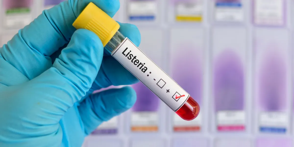 blood sample tube positive with listeria bacteria